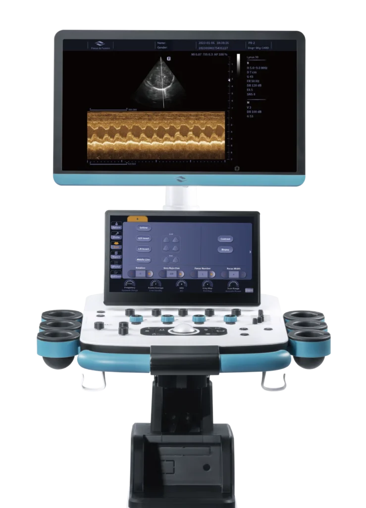 1eb90159 ffa9 4331 9770 5701478f54ad (1)