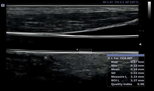 8468f1f9 b7a1 4704 a65e 56f811bdafab