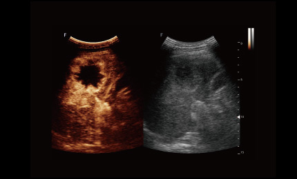 obrazowanie kontrastowe